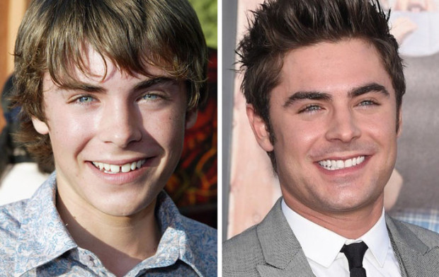 zack efron